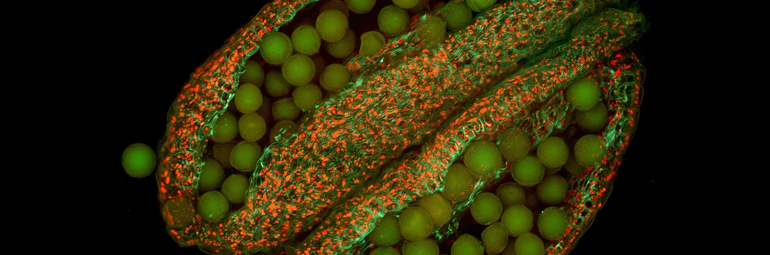 Anther and pollens of thale cress (Arabidopsis thaliana)